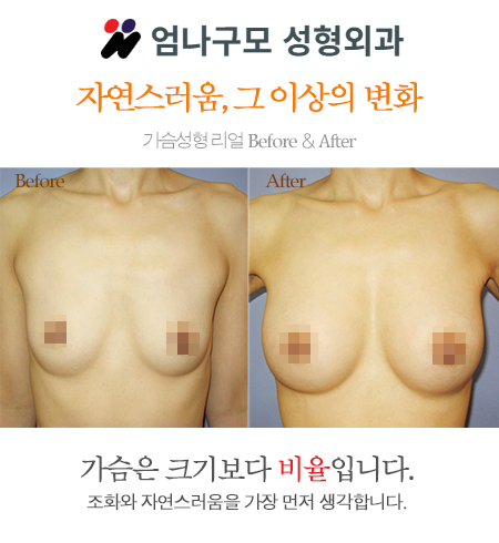 popup-image