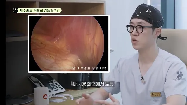 내시경 화면에 비친 얇고 투명한 정상 피막: 혈관·근육·연부조직이 비쳐 보인다