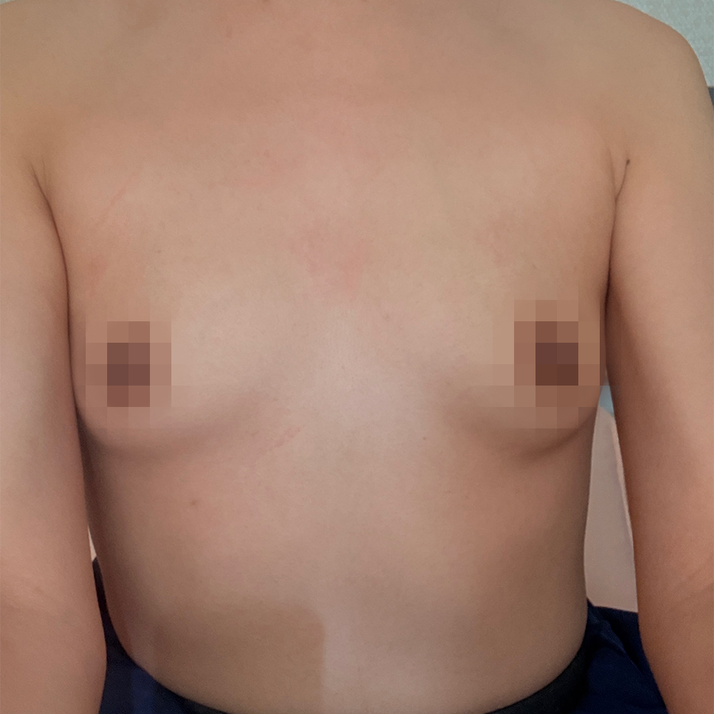 리얼후기 23 사진