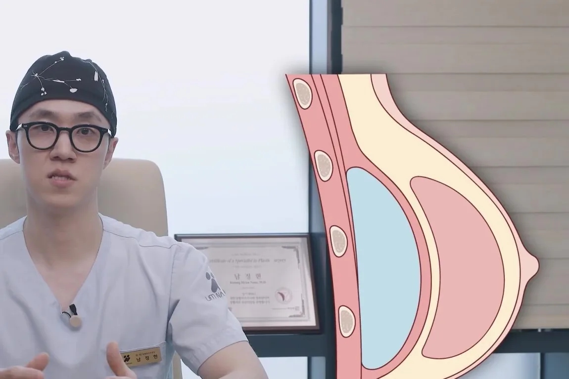 수술모를 쓴 의사 옆에 보형물이 들어간 가슴 단면 그림이 나온 장면