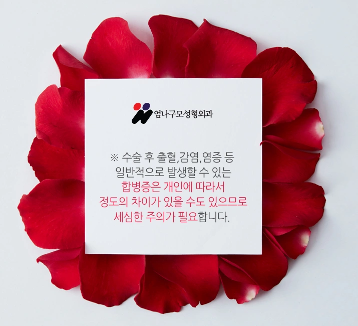 엄나구모성 정보글::가슴확대수술 여름? 겨울? 언제 할까요? 안내 이미지