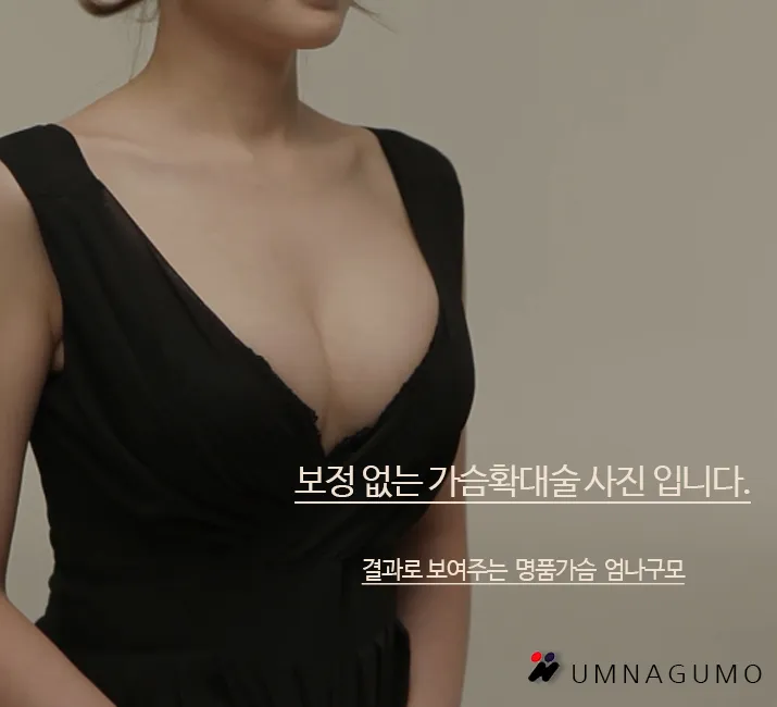 엄나구모성형외과의 가슴확대술 안전하게 하는법 편 안내 이미지