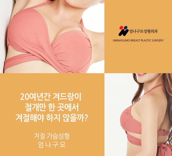 엄나구모 성형외과 정보글 >>> 가슴수술을 위한 똑똑한 계획 안내 이미지