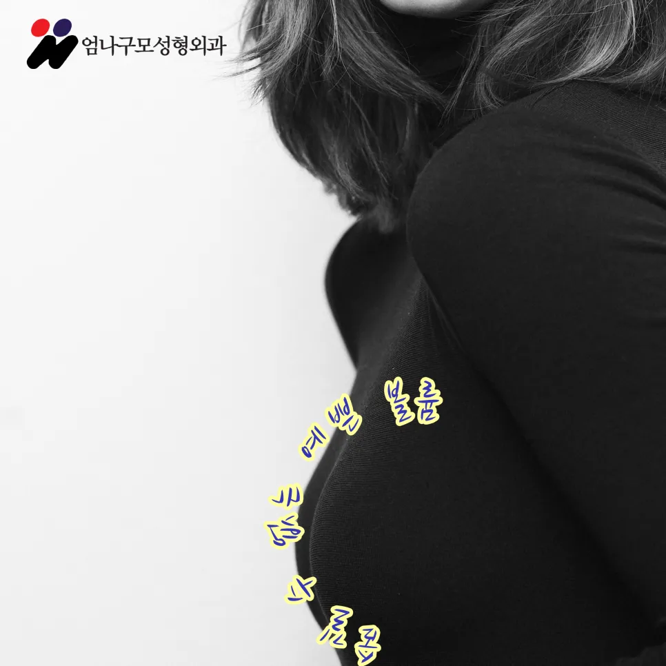 엄나구모 정보글>>> 가슴재수술, 가슴성형은 20여 년간  가슴만 한 곳에서~ 안내 이미지