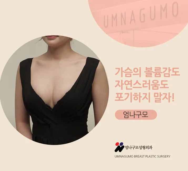 엄나구모 정보글>>> 가슴성형 예쁜가슴라인에 안전 더하기!! 안내 이미지