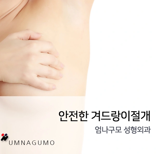 엄나구모성형외과 질문있어요!!::구형구축 궁금해요!! 안내 이미지