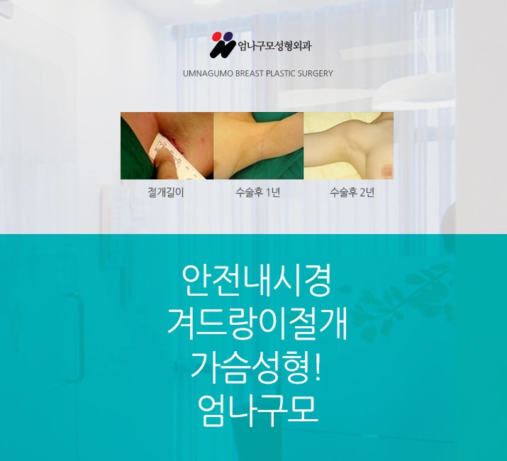 엄나구모 정보글>>> 성공적인 결과의 가슴성형을 위해! 안내 이미지