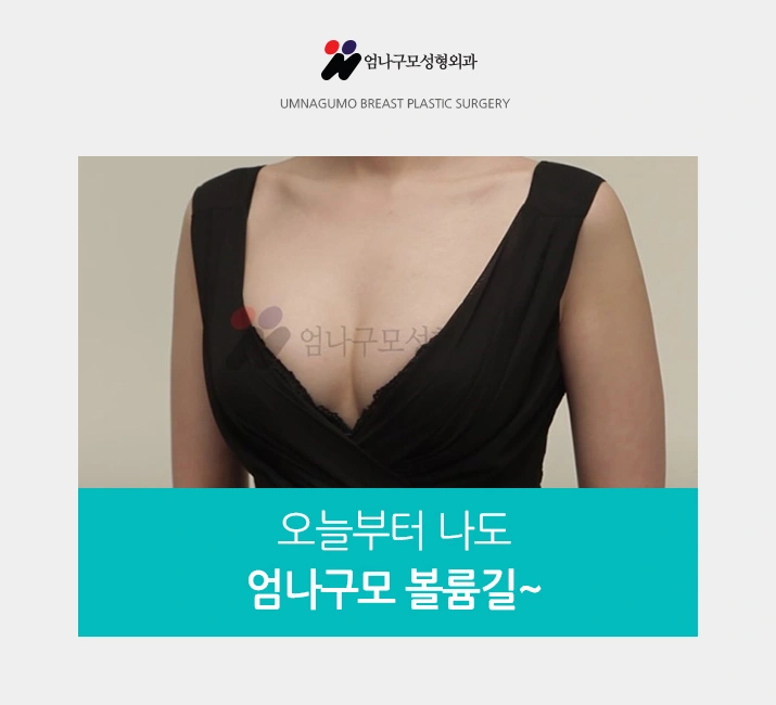 엄나구모 정보글>>> 성공적인 결과의 가슴성형을 위해! 안내 이미지