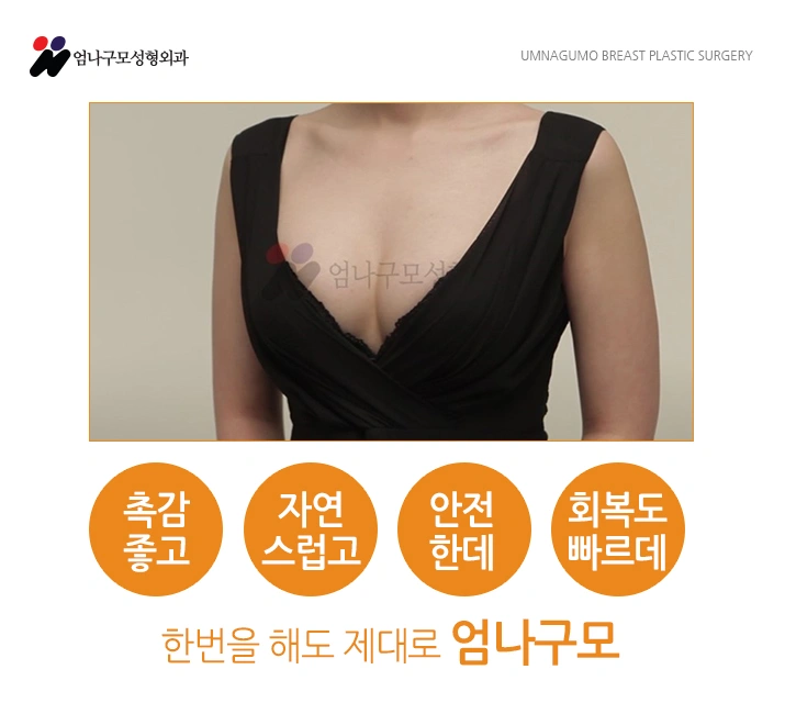 엄나구모 정보글::가슴수술 하고 운동 너무 하고 싶다고요? 안내 이미지