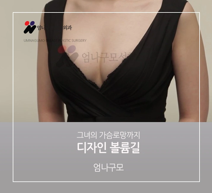엄나구모 정보글>>> 엄나구모 모티바 가슴성형 알고 싶으셨다고요? 안내 이미지