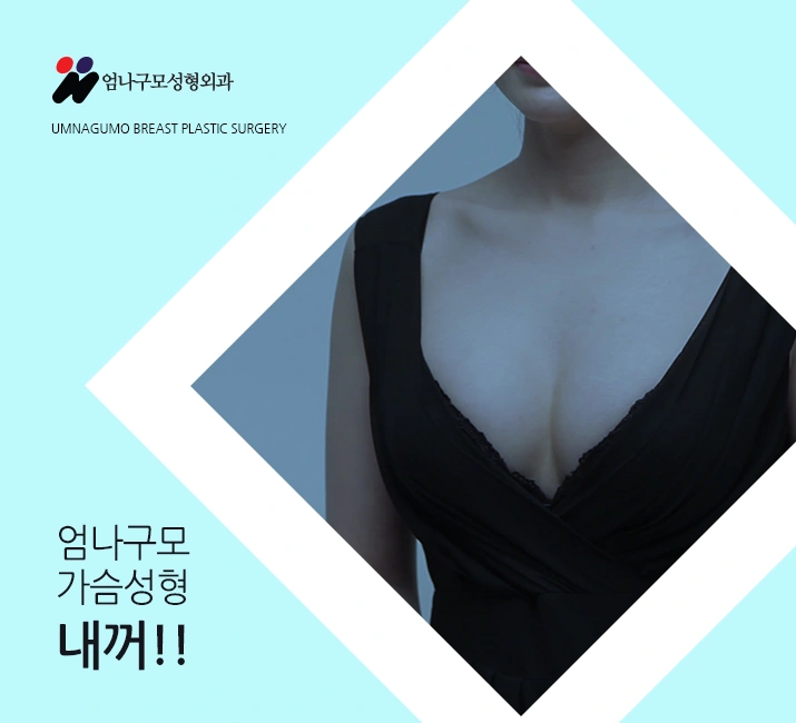엄나구모 정보글 ※ 요즘 가슴성형 트렌드? 안내 이미지