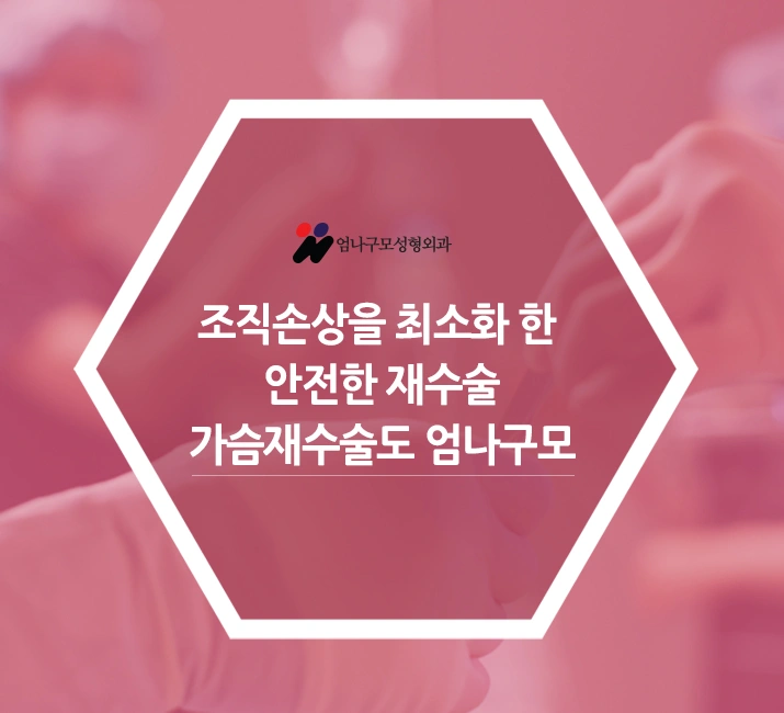 ※엄나구모 정보 글※ 가슴재수술 꼼꼼, 신중!! 안내 이미지