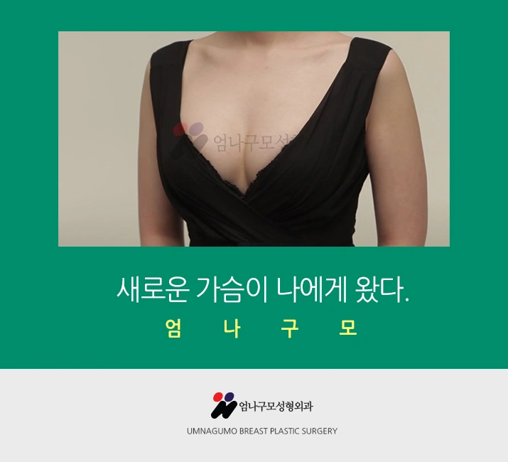 엄나구모 가슴성형>>> 예쁜 가슴성형이 안전하기 까지~~~하면? 안내 이미지