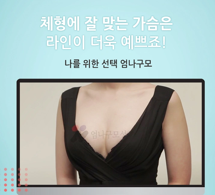 엄나구모정보글 왜 가슴은 엄나구모성형외과인가?! 안내 이미지