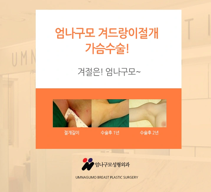 ※엄나구모 정보글※ 꼼꼼하게 알아보는 가슴성형병원!~ 안내 이미지