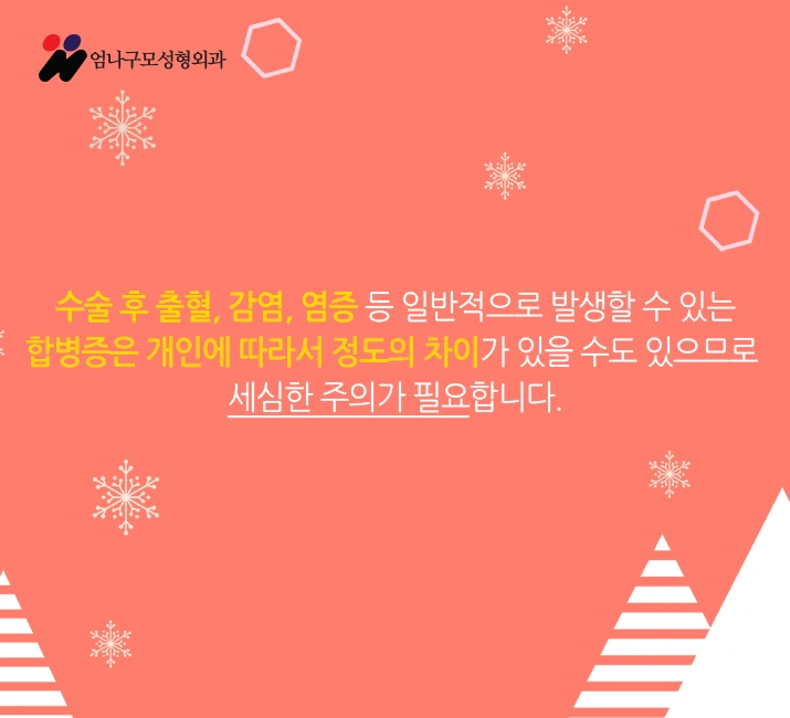 엄나구모 성형외과) ) 모티바 가슴성형 안내 이미지