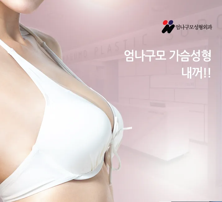 ※가슴성형 고민하시는 분들 주목 엄나구모 모티바가슴성형정보!! 안내 이미지