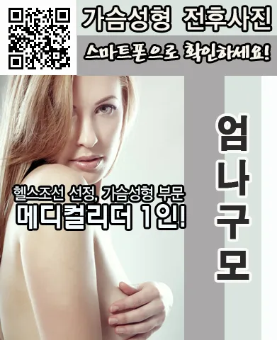 가슴성형잘하는병원의 가슴성형 특장점 안내 이미지