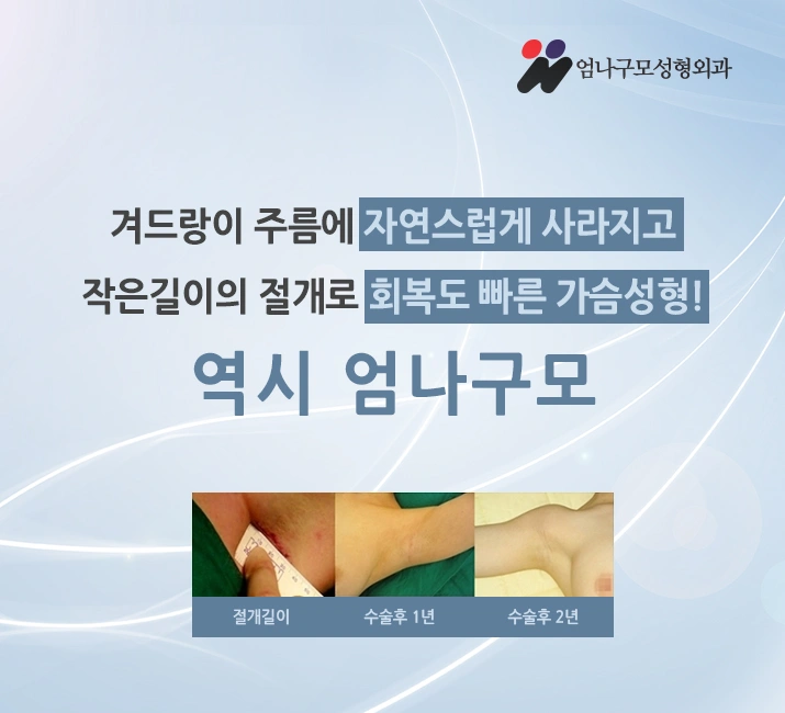 풍만한 볼륨도 안전하게 얻어야죠. 엄나구모성형외과! 안내 이미지