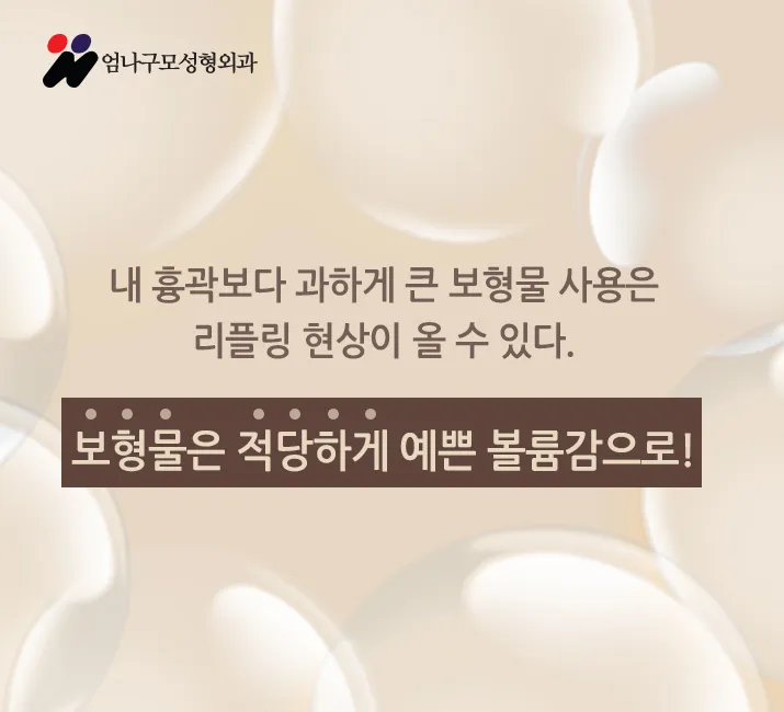 엄나구모 정보글※ 모티바 보형물 가슴성형 안전하게! 안내 이미지
