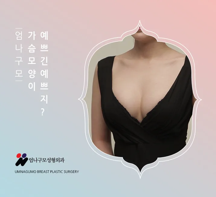 엄나구모정보글>> 가슴성형 쉬운 수술이 아니잖아요? 안내 이미지