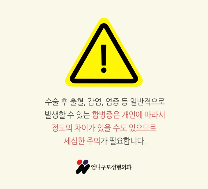 ※엄나구모 정보 글※ 가슴재수술 꼼꼼, 신중!! 안내 이미지