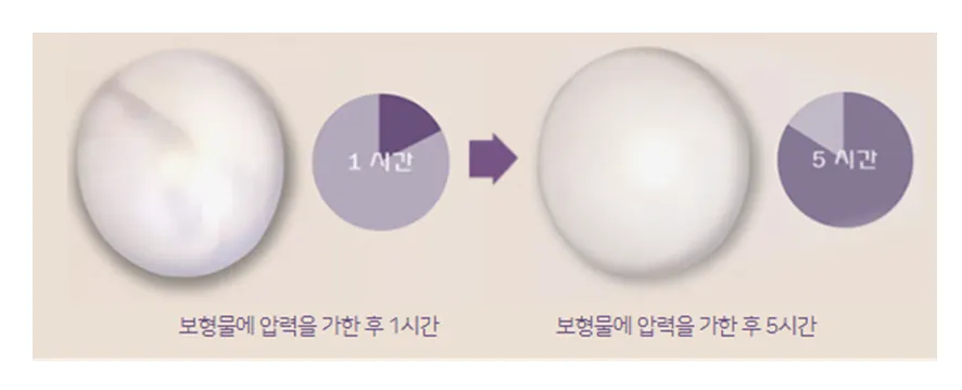 세빈(Sebbin) 보형물, 프랑스 프리미엄 가슴 보형물의 선택 안내 이미지