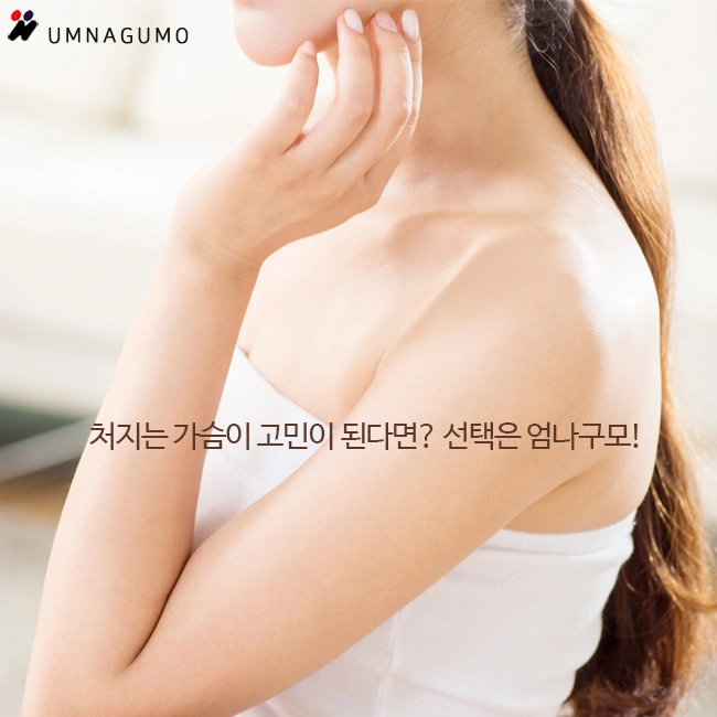 엄나구모 성형외과 도와줘요!! 가슴이 처져요ㅠㅠ 안내 이미지