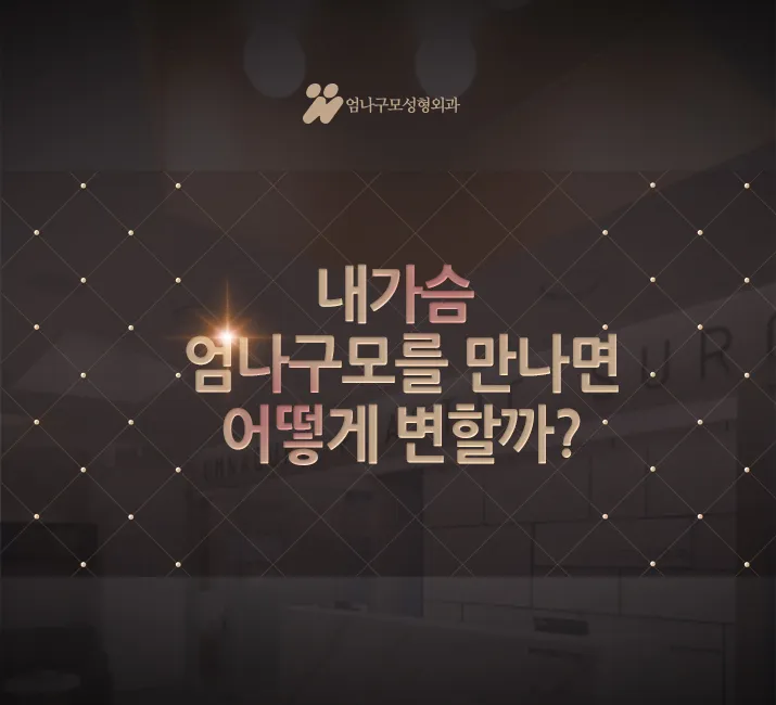 엄나구모정보글 / 가슴성형 자연스러우면서 예쁜볼륨 편 안내 이미지