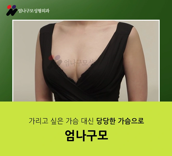 엄나구모의 안전을 바탕으로 하는 가슴재수술 안내 이미지
