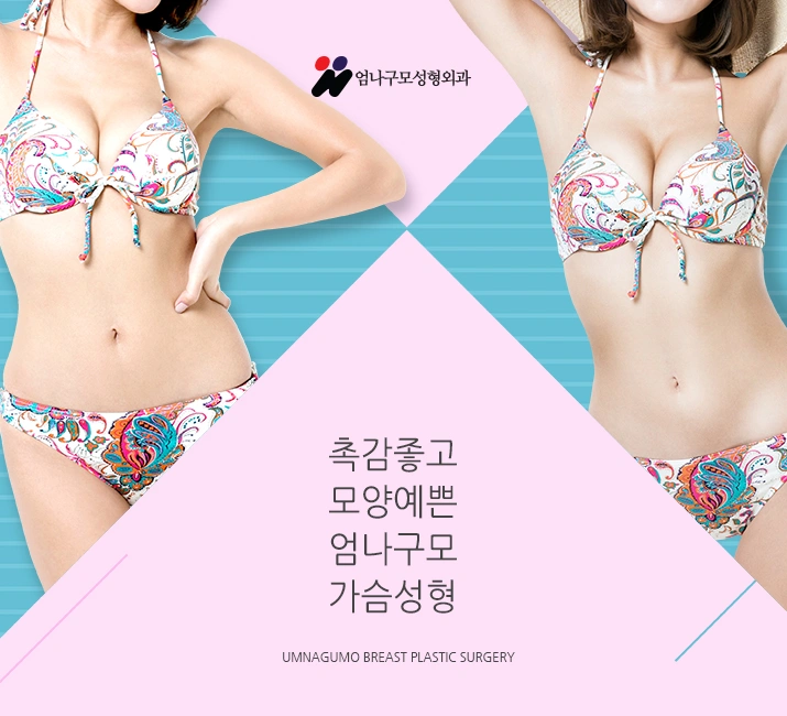 엄나구모 정보글 ::: 모티바 가슴성형 편 안내 이미지