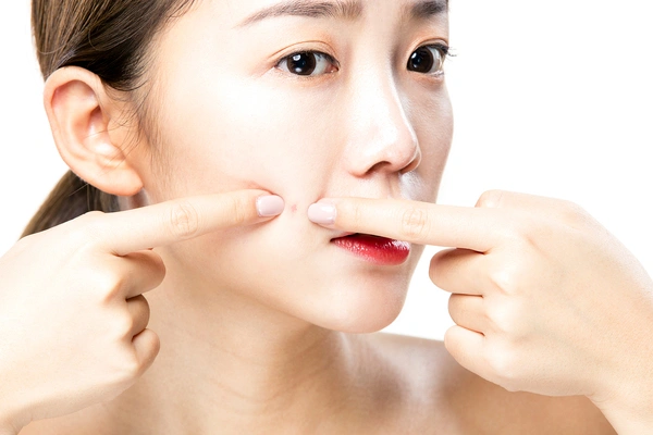 뷰티정도 블랙헤드 짜도 될까? 안될까? 안내 이미지