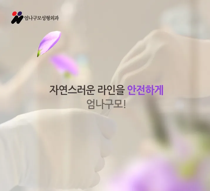 엄나구모정보글※엄나구모 성형외과의 가슴성형! 안내 이미지