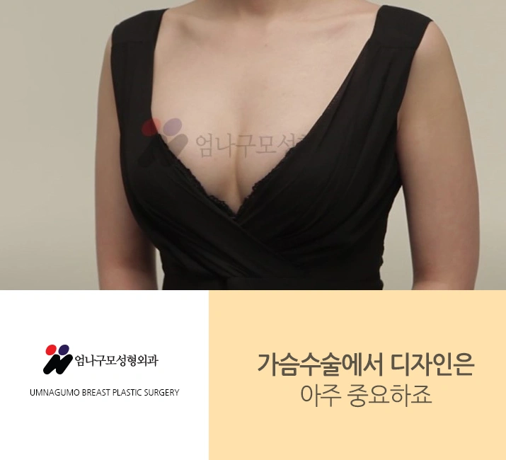 엄나구모 정보글:: 가슴성형마취 걱정없는 엄나구모~~ 안내 이미지