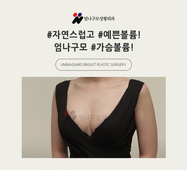 엄나구모 정보글 ※ 가슴성형 매력 있는 볼륨 안전하게~ 안내 이미지
