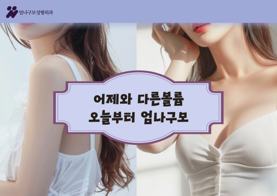엄나구모성형외과 정보글 여성들의 가슴성형 안내 이미지