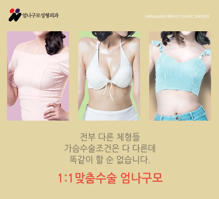 엄나구모 성형외과::짝가슴 너무 스트레스죠? 안내 이미지