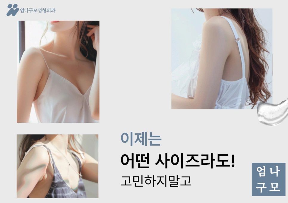 엄나구모성형외과: 가슴 성형의 모든 것 &ndash; 보형물 선택부터 병원 선택까지 안내 이미지