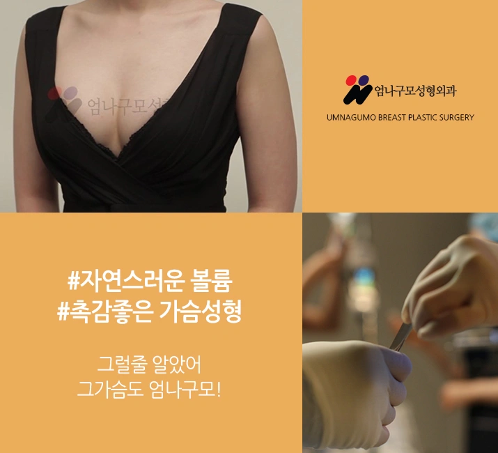 엄나구모 정보글>> 안전이 수술모토 엄나구모 가슴성형! 안내 이미지