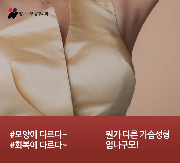 ※엄나구모 정보글※가슴성형! 모티바성형! 궁금해요~ 안내 이미지