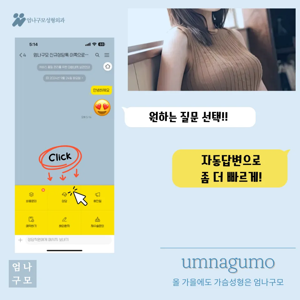 엄나구모성형외과 정보이야기 모티바만 생각하고 계세요? 안내 이미지