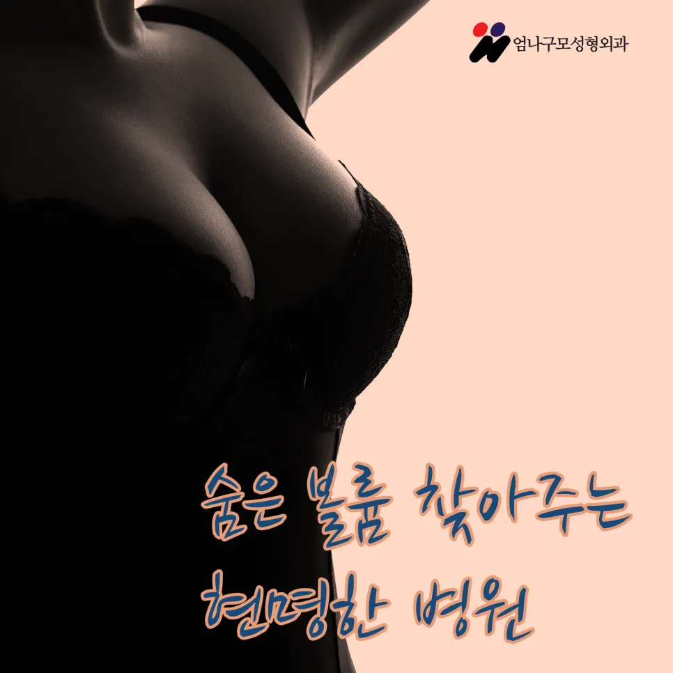 엄나구모 정보글>>> 가슴재수술, 가슴성형은 20여 년간  가슴만 한 곳에서~ 안내 이미지