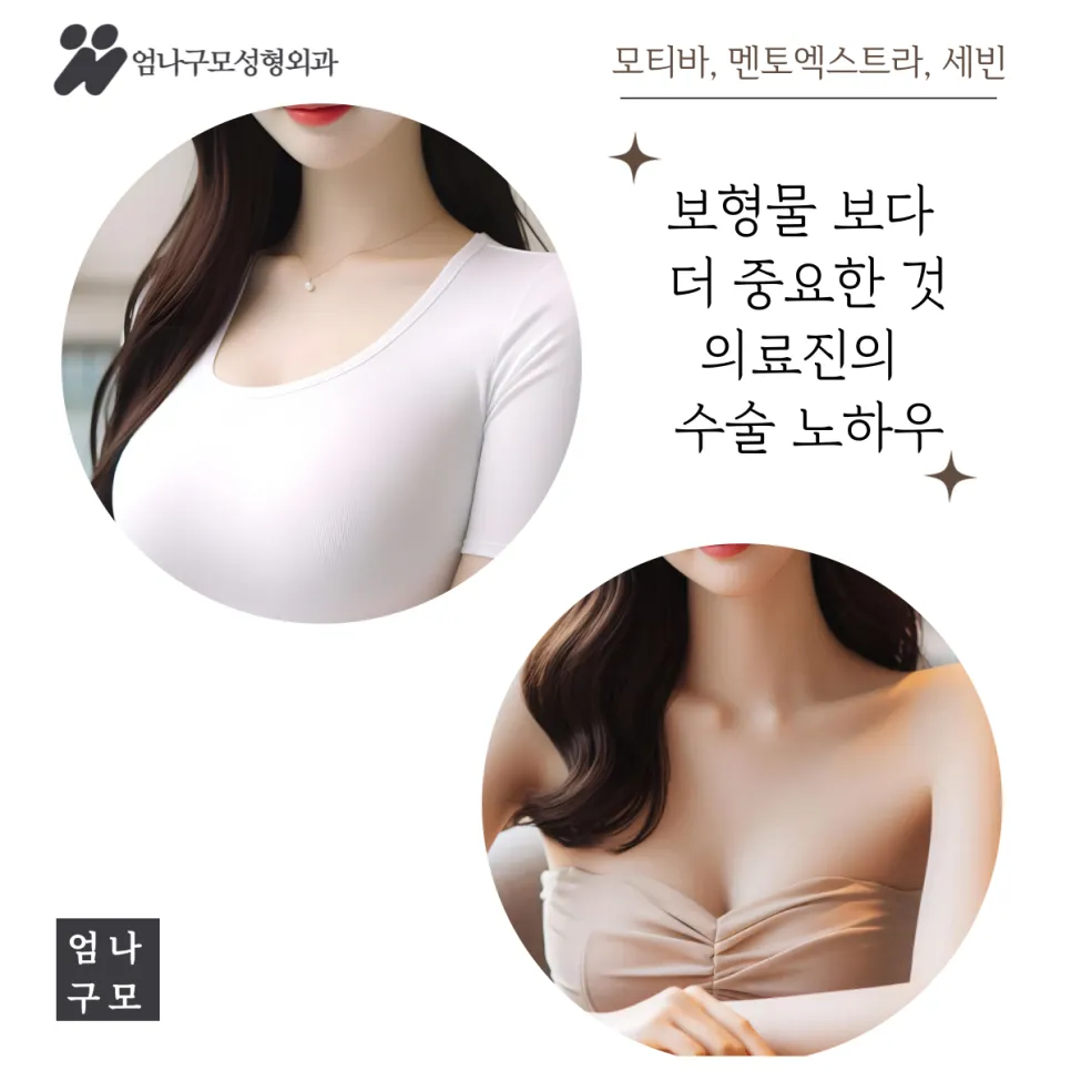 엄나구모성형외과 정보글 자연스럽고 안전한 가슴 성형, 지금의 트렌드 안내 이미지