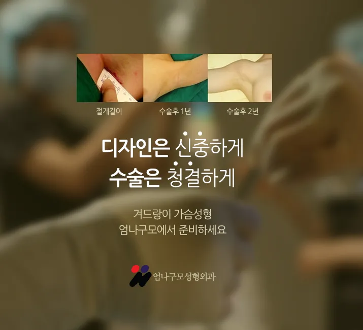 모티바 가슴성형 안전하게 대표원장님께 직접!! 안내 이미지