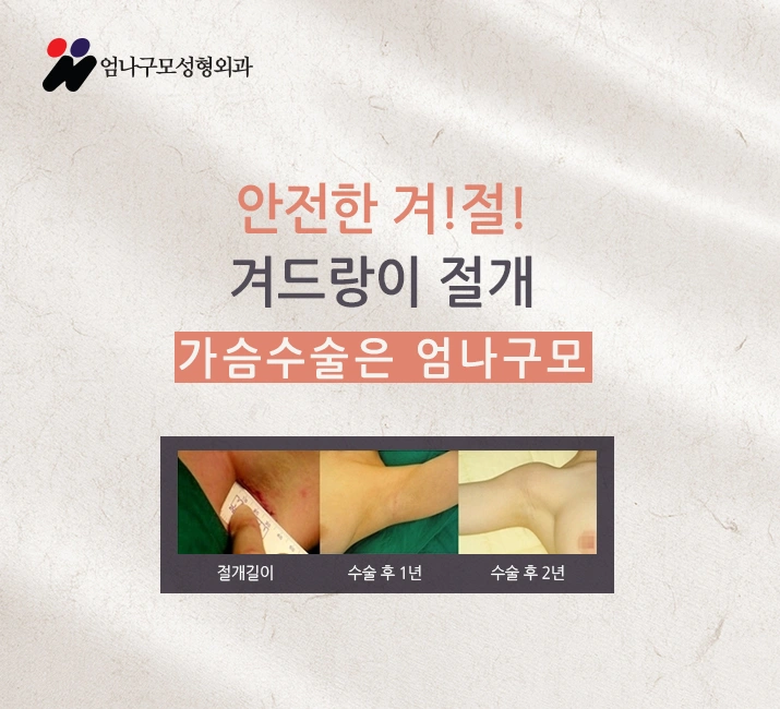 엄나구모정보글 왜 가슴은 엄나구모성형외과인가?! 안내 이미지