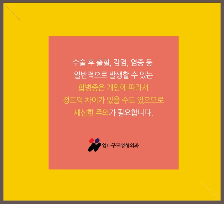 엄나구모 정보글>>> 가슴성형 절개법 궁금하신 분들 드루와요~~~ 안내 이미지