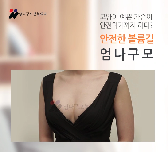 엄나구모 정보글 ※ 자연스런 보형물에 엄나구모 수술스킬 추가한 가슴성형 안내 이미지
