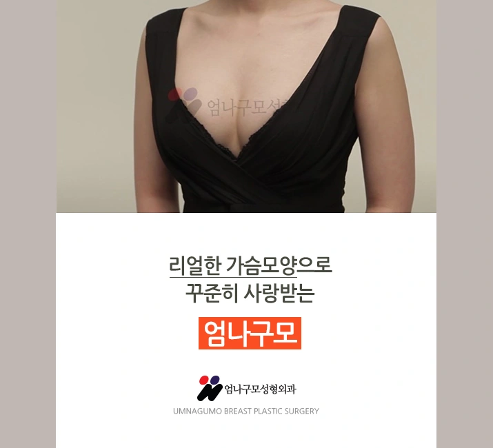엄나구모 정보글>> 대표원장님께 직접받는 나만의 디자인 가슴성형 안내 이미지