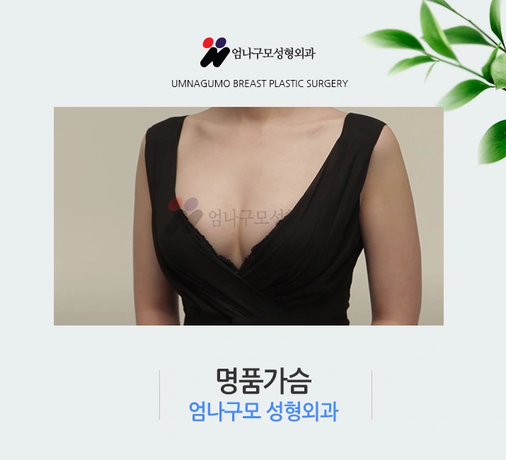 엄나구모 정보글 ※ 매력적인 가슴성형도 안전하게 안내 이미지