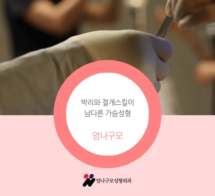 엄나구모 정보글 ※ 가슴재수술 당연히 더 선택이 어렵죠.~! 안내 이미지
